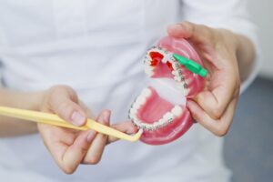Lee más sobre el artículo Carreras de asistente de ortodoncista